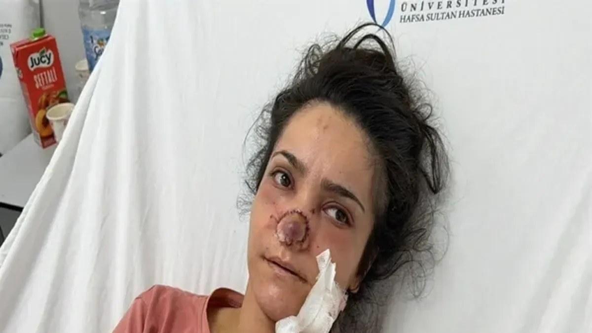 Manisa'da herkesi şoke eden olay! Eşinin burnunu koparmıştı... Cani eşe karar çıktı